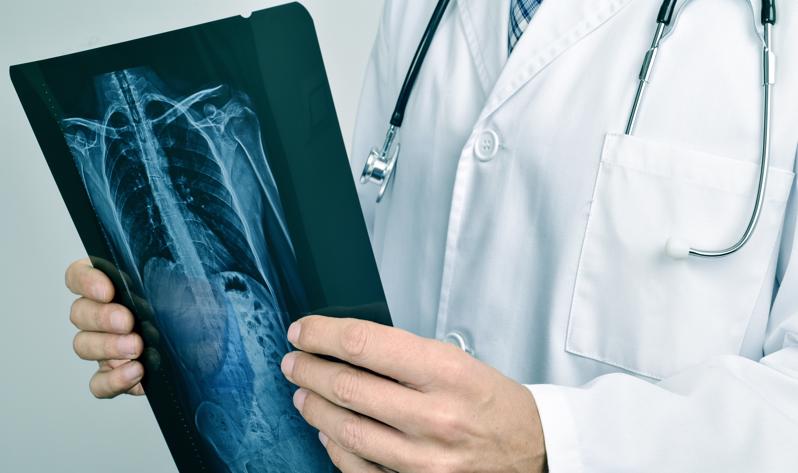 A doctor examining an X-ray of a back personal injury.