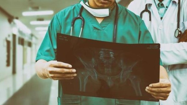 doctor looking at x-ray of fractures